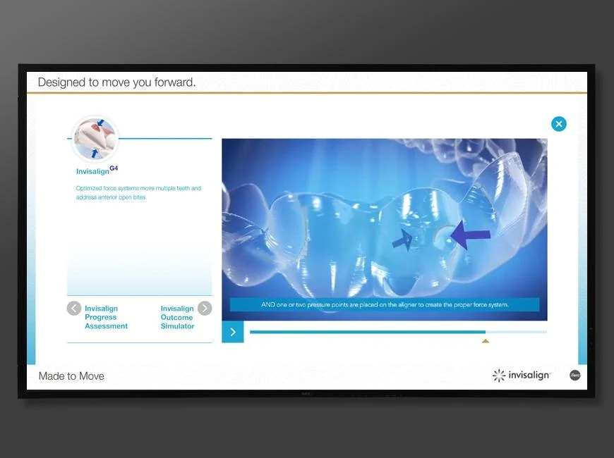 Invisalign timeline interface displaying a dental animation and playback controls.